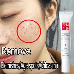 Whitening and Freckle Removing Cream Whitening Serum Light spots Brighten skin translucent Essence 20g Remove Dark Spots Anti Freckle Cream Niacinamide Fade Pigmentation Melasma Brighten Creams Bintik menghilangkan / Chloasma / Bintik-bintik penuaan