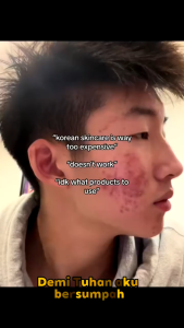 [BPOM] MAKAIRA 3 Varian Gentle Exfoliating Scrub Cleanser By Kormesic Smooth And Non Irritating 100g