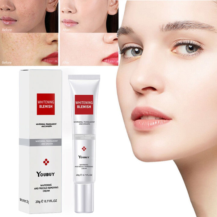 【BPOM】Youbuy Whitening Freckle Cream Whitening Blemish - Penghilang ...