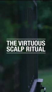 Previa Dry Dandruff Cleansing Shampoo 100ml