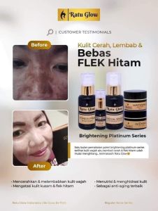 KREAM WAJAH GLOWING  RATUGLOW  PLATINUM