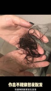 Fast hair growth hair loss serum hair Anti -hair loss oil tonic powerful hair ori 60g man hair loss care m-shaped stay up Hair loss for man and women