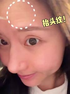 Peking University and Xiehe Collaboration OHBT Astaxanthin Tranexamic Acid Essence Cream Whitening Moisturizing Brightening Firming Anti-Aging