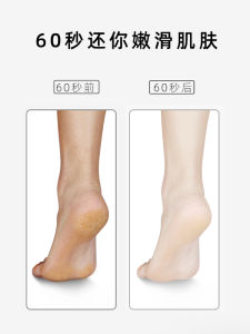 New Nano Glass Popular Callus Remover Foot File Dead Skin Removal Foot Heel Callus Foot Bottom Care Rubbing Board Grinding Stone