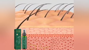 Ouhoe Ginseng Hair Tonic Fast Hair Growth Anti-Hair Loss Repair Baldness Damaged Hair Regrowth Essence 100ml