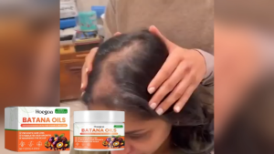 Hoegoa Batana Oil Treatment Stimulates Hair Growth Improves Hair Density Enhances Shine Hair Care 120g