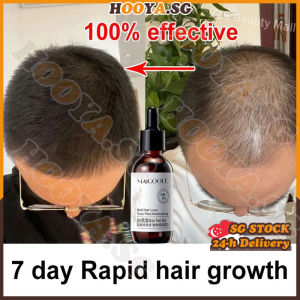 ✅SG stock✅ Hair growth serum for men women / Anti hair loss serum / Hair fall treatment / Hair loss tonic / Ginger hair tonic