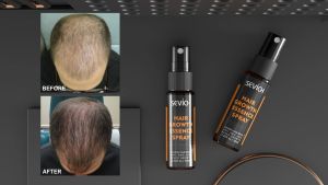 SEVICH Hair Growth Spray Ginger Essence 30ml Prevent Hair Loss