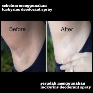 PENGHILANG BAU BADAN PENGHILANG NODA KUNING PADA KETIAK