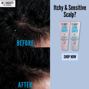 [Exp: Dec 2026] [Sensitive Scalp] Noughty Care Taker Scalp Soothing Conditioner 250ml–97% Natural Anti-Itch Eczema-Safe