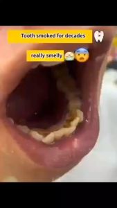 Pasta gigi pemutih gigi menghapuskan tartar gigi membersihkan gigi kunung bau mulut segar pemutih pasta gigi anak