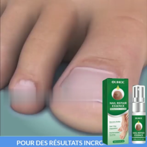 OUHOE Nail Strengthener Repair Damaged Nails Nail Growth Treatment Cuticle Care 10ml