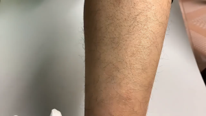 Epilator Penghilang Bulu Crystal Hair Remover Ketiak Manual Tanpa Sakit Iritasi Reusable