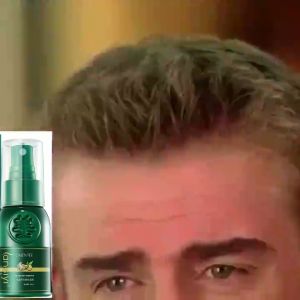 Natural Ginger Germinal Oil Liquid Hair Tonic Hair Health Care Nourishing Nutrient Herbal Formula Serum for Promoting Thick and Dense Hair Growth 300ml/30ml