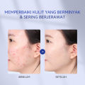 Dr.Leo Polyamino Acid Purifying Facial Cleanser +Dr.Leo Salicylic Acid Acne Treatment Drying Lotion +Dr.Leo Amazon White Deep Pores Cleansing & Purifying. 