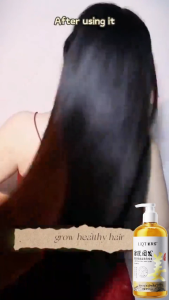 Shampo Penumbuh Rambut Cepat Ginger Shampoo 500ml pertumbuhan rambut Pengendalian Minyak Anti rambut rontok Botak shampo penumbuh rambut sampo anti ketombe dan rontok Anti Hair Fall Hair Treatment Shampoo Mengurangi Rambut Rontok