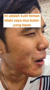 READY STOCK SERUM AWET MUDA Serum original Multiple Repair Collagen Essence Lifting Firming Skin Care