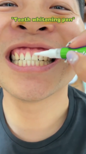 Probiotic Teeth Whitening Pen Paint Stain Removal Tartar Remover  Effectively remove stains and yellow teeth