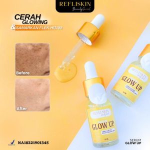 Serum Glow Up Original Refliskin - Serum Peeling 30ml (AHA & NIACINAMIDE) + Serum Glow Up 10ml (Cromabright) - Wajah & Badan - 100% Original & Halal MUI (BPOM) (7 Hari)
