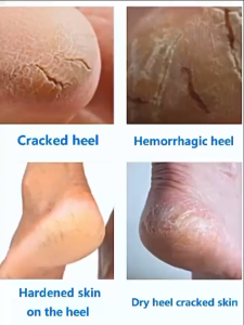 Aichun Tangan Krim Kaki Anti-Chafing Kulit Memperbaiki Pelembab untuk Kasar Kering dan Retak Kaki Pecah-pecah Tumit