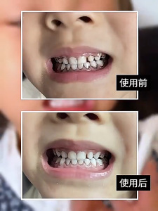 Nano Eraser Teeth Cleaning Wipe Kids Tartar Removal Plaque Stain Removal Sponge Scrubs Hot Teeth