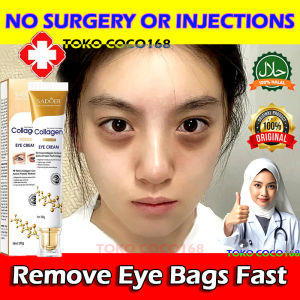 【100% Asli】SADOER Eye Cream Collagen 20g Eye Serum Masker Mata Panda Mengurangi Garis Halus Dan Kantong Mata Menghilangkan Mata Panda Anti-Aging Moisturizing keriput-obat kantung mata paling ampuh - COD