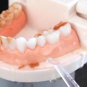 Powerful Oral Irrigator Water Flosser Teeth Multifunctional Water Jet Nozzle Portable Floss Teeth Cleaner Dental Floss