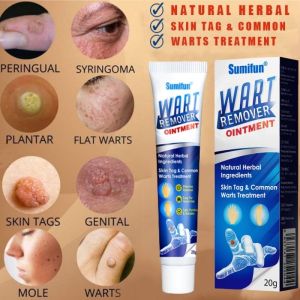 Clara.Warts Remover Original Cream Warts Magic Remover Warts Remover Skin Kulugo Remover Skin Growth Effectively Remove Common Warts Flat Warts Filamentous Warts and Sharp Warts Face and neck Painless Removal Skin Tag Warts Remover Mole Warts Remover