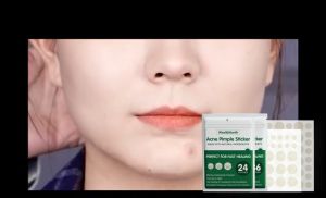 West&Month Acne Removal Patches: A Comprehensive Guide