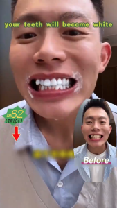 Fast whitening Whitening toothpaste Teeth Whitening 120g Probiotic Toothpaste Fresh Breath Remove Tooth Stains Yellow Tooth Whitening restores damaged gums and Prevent Caries