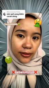 Zalfa natural AKUN RESMI  Paket  lightening series