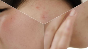 COSRX Low pH Good Morning Gel Cleanser 150ml | Suitable for sensitive and dry skin