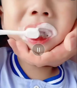 B 1 T 3 Childrens Fluoride Toothpaste Rich In Vitamin C Fruity Flavor Prevents Cavities Gentle And Non-Irritating Cares For Childrens Sensitive Gums Suitable For Ages 1-12