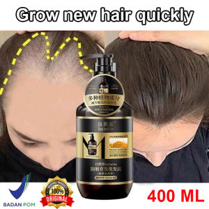 Anti-Hair Loss Shampoo Hair growth shampoo Polygonum Multiflorum Shampoo Anti hair loss/Fast hair growth/Anti dandruffNourishes the scalpd