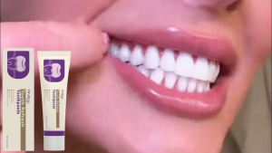 [In Stock] Oralhoe Teeth Whitening Toothpaste 100g suitable for sensitive mouths gently cleans teeth removes plaque and tartar and freshens the air.