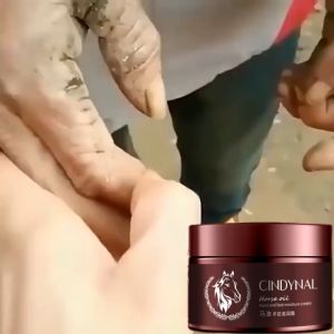Kem dầu ngựa dưỡng da chân chống nứt nẻ và thô ráp，mềm da chân Ngựa nứt gót sừng hóa tay chân/Whitening repair foot cream，Foot care110g