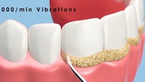 2-in-1 Electric Toothbrush With 1*Toothbrush Head 1*Tartar Cleaning Needle Quickly Clean Tartar Toothbrush Ultrasonic Vibration Electric Toothbrush Protect Teeth 30000 Vibrations/Minute