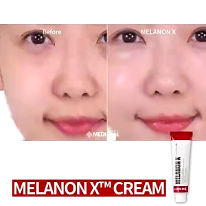 MEDIPEEL Melanon X Cream 30ml | High-Concentration Brightening Cream with 2% Niacinamide & Melasolv™ | Melasma & Dark Spot Care for All Skin Types