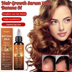 Batana Hair Oil Nourishes Hair Roots Strengthens Hair Promotes Hair Growth Improves Dryness And Frizz Prevents Hair Loss Hair Care