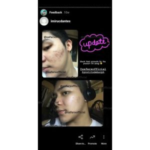 Saferx Korean Skin - Korean Skincare Whitening - Brightening - Dark Spot Treatment - Even Skin Tone - Radiance Boost - Anti-Aging - Skin Lightening - Whitening Serum - Moisturizer - Face Cream - Formulated with Arbutin Licorice Extract and Vitamin C