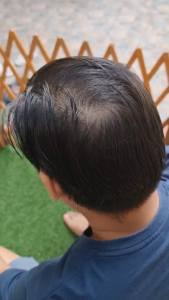 Kingyes สเปรย์ปิดผมบาง สเปรย์ปกปิดหัวล้าน สเปรย์แก้หัวล้าน สเปรย์ปิดผมน้อย สเปรย์ปิดหนังศีรษะ สเปรย์ผมไฟเบอร์ ผลิตจากสารธรรมชาติ