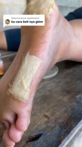 Tumitku Obat Kaki Pecah2 Paling Ampuh - Tumitku Obat Kaki Rayapan Pecah2 Ori Kering Parah