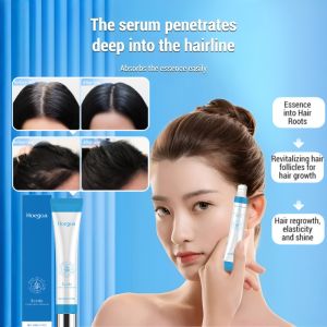 Rollerball Treatment Essence: A Portable Solution for Nourishing Hair Care