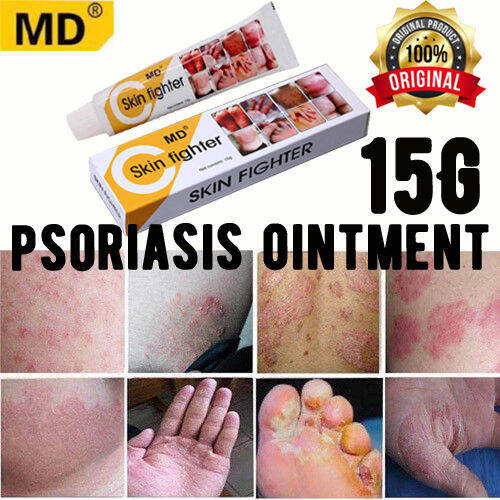 MD SKIN FIGHTER CREAM 15g Stop Itching quickly magic skin cream、chronic ...