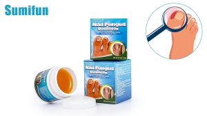 Cream Perawatan Kuku Original - Nail Fungus