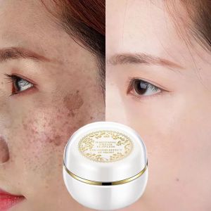 【New Formula】Face Whitening Cream concealer black spot remover cream 30g moisturizing brightening Face spotted cream Skin White Night Cream
