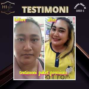 Paket Ultimate Night Glow |HI Glow Skincare