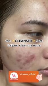 France 236ML SA Smoothing Cleanser Renewing Salicylic Acid Face Wash Hyaluronic Acid for Acne Rough Bumpy Skin