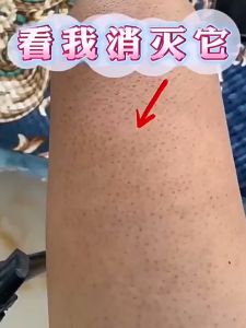 500g超大 维生素原 B5 保湿霜 大白罐 补水 防冻 防干裂 身体乳 全身可用  Spot Super large bottle] provitamin B5 moisturizing cream large wh