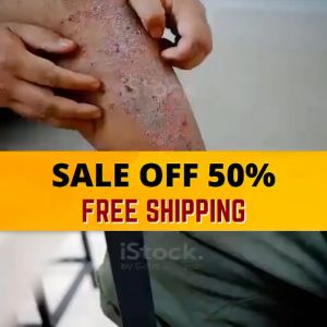 HERBAL ANTI-BACTERIA CREAM Antibacterial Pslergiesoriasis Cream Dermatitis Eczema Treat Ointment 30g